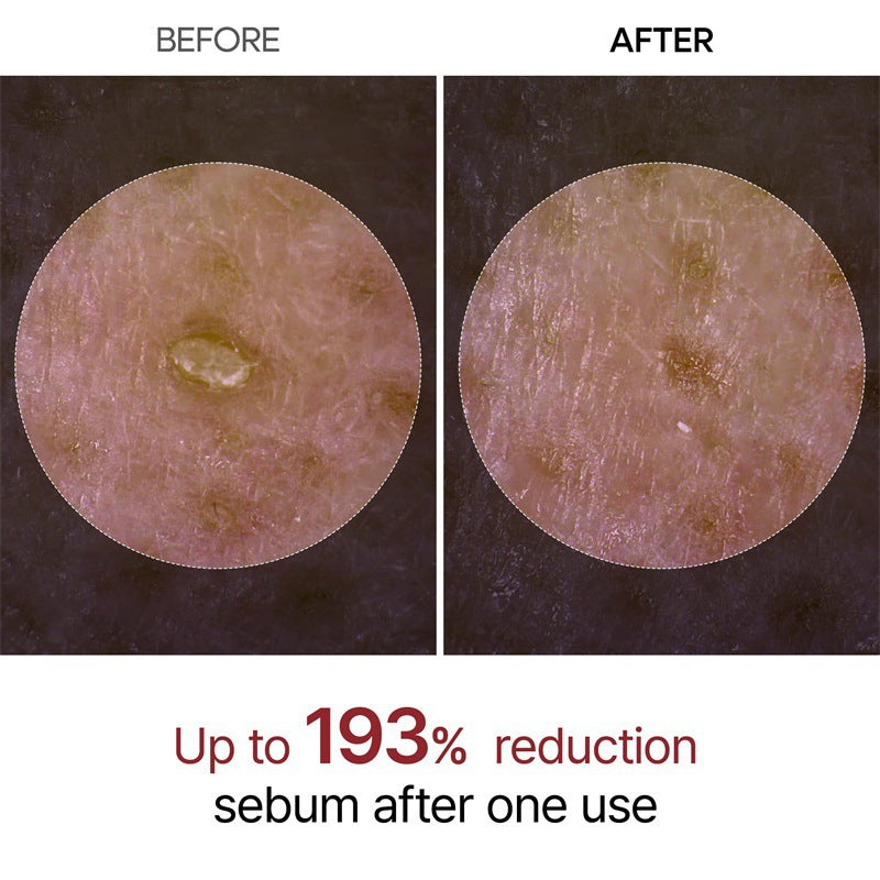 Peel Shot Glow